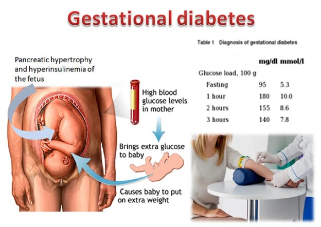 Gestational Diabetes sensitization